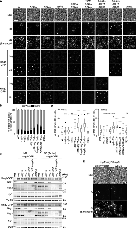 A multi-panel image showing lipid droplet accumulation in yeast cells under different conditions.