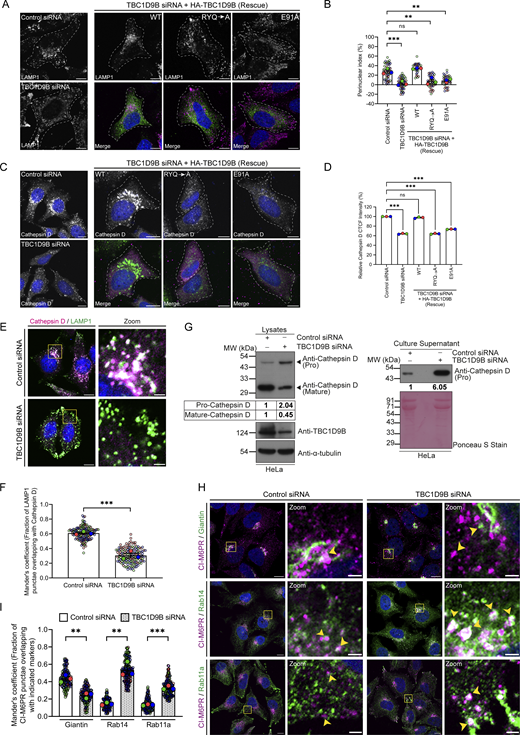 A multi-panel image depicts the impact of TBC1D9B depletion on lysosome morphology and function in HeLa cells.