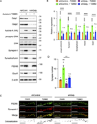 Constitutively active Aurora-A rescues synaptogenesis defects caused by Gstp knockdown. Aurora-A T288D restores synaptic marker expression in Gstp-deficient neurons. (A) Representative immunoblots of the indicated proteins. Cortical neurons were co-transfected with shRNAs targeting Gstp1/2 and the HA-tagged Aurora-A T288D mutant. Gstp knockdown, T288D mutant expression, phosphorylated ERK, and various synaptic markers were analyzed. β-Actin serves as a loading control. (B) Quantification of ERK phosphorylation (phospho-ERK/total ERK), presynaptic markers synapsin I and synaptophysin, and postsynaptic markers PSD95 and GluA1. All values are normalized to β-actin and relative to mock-transfected controls (mean ± SEM, n = 3). Significant differences from the control (*P < 0.05; **P < 0.01; ***P < 0.001; ****P < 0.0001; n.s., not significant, P > 0.05) were determined by one-way ANOVA followed by Tukey’s multiple comparisons test. (C and D) The Aurora-A T288D mutant compensates for the loss of Gstp in synapse formation. Representative images (C) of cortical neurons (DIV14–16) expressing Gstp1/2 shRNAs and the Aurora-A T288D mutant, double-immunostained for PSD95 and synapsin I. Colocalization panels show synaptic puncta (bottom panels; black) as double-positive signals (see Fig. S4, A and B). Scale bar, 10 μm. Quantification shows the number of synapses per unit dendritic length in D. Significant differences (**P <0.01; n.s., not significant, P > 0.05) were determined by one-way ANOVA with Tukey’s post hoc test for all possible pairs, including the comparison between shControl and shGstp + T288D. Note that the reduction in synapse formation induced by Gstp knockdown is significantly rescued by expression of the Aurora-A T288D mutant, returning to levels comparable with those of the control (P > 0.05, shControl vs shGstp + T288D). Source data are available for this figure: SourceData F7.