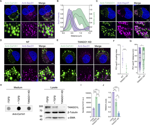 A multi-panel image analyzes the interaction between PC1 condensates and TANGO1 at ER exit sites in LX-2 cells.