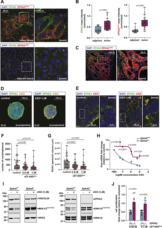 A multi-panel image showing various experiments related to EPHA2 expression and its effects in pancreatic ductal adenocarcinoma.