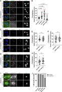 A multi-panel image showing kinetochore recruitment and spindle assembly in various genetic lines.
