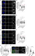 A multi-panel image showing CID assembly in spermatids and prometaphase I cells.