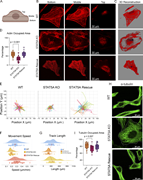 A multi-panel image showing the effects of STAT5A KO on actin and tubulin networks in cells.