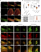 A multi-panel image showing actin and alpha-actinin-1 in cells.