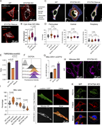 A multi-panel image showing mitochondrial organization and function in different cell types.