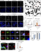 A multi-panel image showing various types of visual data, including immunofluorescence staining, bar graphs, and representative images of cells.