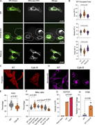A multi-panel image showing the spatial distribution of the endoplasmic reticulum and mitochondria in different cell types and treatments.