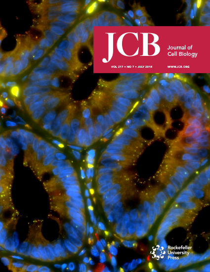 Glutathione metabolism in cancer progression and treatment resistance | Journal of Cell Biology