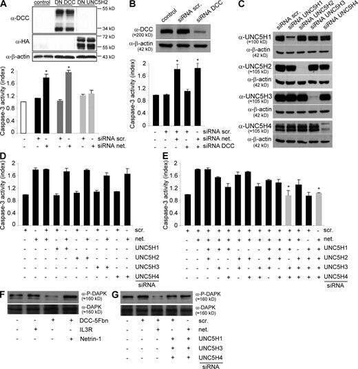 Figure 5. NB tumor cell death occurs via UNC5H/DAPK proapoptotic signaling. (A) Quantification of cell death in IMR32 cells transfected with either a dominant-negative mutant for DCC proapoptotic activity (DN-DCC) or a dominant-negative mutant for UNC5H proapoptotic activity (DN-UNC5H). Top: DN-DCC and DN-UNC5H proteins expression were analyzed by Western blot. Bottom: cell death was quantified by measuring relative caspase-3 activity after scramble or netrin-1 siRNA transfection. SEM are indicated. Data are means of three independent experiments. *, P < 0.05 calculated using a two-sided Mann-Whitney test compared with level of control. (B) Quantification of cell death in IMR32 cells transfected with either a scramble siRNA or a netrin-1 siRNA together or not with a DCC siRNA. Top: DCC siRNA efficiency was verified by Western blotting on HEK293T cells transfected with pCR-hDCC together with scramble or DCC siRNA. Bottom: cell death was quantified by measuring relative caspase-3 activity. Data are means of three independent experiments. SEM are indicated. *, P <0.05 calculated using a two-sided Mann-Whitney test compared with level of control. Similar results were obtained when neogenin or MYCN were down-regulated (Fig. S3 A). (C) Analysis of specificity and efficiency of each UNC5H siRNA by Western blot in HEK293T cells transfected with UNC5H1, H2, H3, or H4 encoding vector together with each UNC5H siRNA. (D and E) Quantification of cell death in IMR32 cells transfected with either a scramble siRNA or a netrin-1 siRNA together with various combinations of UNC5H siRNA, i.e, one UNC5H (D) or two or four UNC5H (E). Apoptosis was monitored by measuring relative caspase-3 activity. The use of combined UNC5H1, UNC5H2, UNC5H3, and UNC5H4 or UNC5H1, UNC5H3, and UNC5H4 siRNAs, leading to the absence of death induced by netrin-1 siRNA, are presented in gray. Data are means of three independent experiments. Error bars indicate SEM. *, P <0.05 calculated using a two-sided Mann-Whitney test compared with level of control. (F and G) Immunodetection of phosphorylated DAPK (P-DAPK) in IMR32 cells either treated with DCC-5Fbn (F) or transfected with netrin-1 siRNA alone or with UNC5H1, H3, and H4 siRNAs (G). In F and G, immunodetection was performed on three independent experiments.