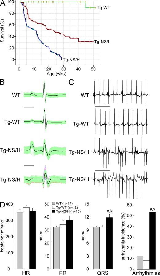 Figure 2. Characteristics of transgenic mice with cardiac-restricted expression of N271S-dsg2. (A) Kaplan-Meier survival plot of Tg-NS/H (blue line; n = 225), Tg-NS/L (red line; n = 156), and Tg-WT (green line; n = 129) mice. Note the high death rate in the mutant lines, with 30% of death occurring by 3.6 wk in Tg-NS/H mice. (B) Examples of surface ECG measurements from WT, Tg-WT, and Tg-NS/H mice showing prolongation and fractionation of the QRS complex, indicating impairment of ventricular conduction. Bar, 25 ms. (C) Typical ECG examples of spontaneous ventricular arrhythmias observed in Tg-NS/H mice. Bar, 500 ms. (D) Mean values of ECG parameters including heart rate (HR), PR and QRS intervals, and incidence of spontaneous arrhythmias. Data represent means ± SEM measured from >200 consecutive beats from single independent ECG measurements in 17 WT, 12 Tg-WT, and 15 Tg-NS/H mice (#, P < 0.05 vs. WT; $, P < 0.05 vs. Tg-WT; Table S1).