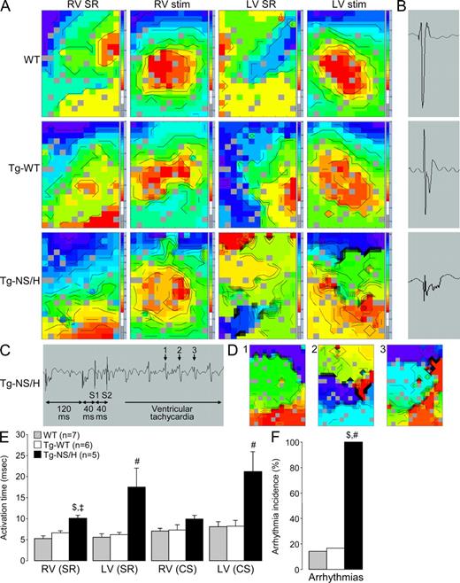 Figure 4. Epicardial mapping experiments in Langendorff-perfused hearts. (A) Examples of RV and LV activation maps for WT, Tg-WT, and Tg-NS/H hearts during sinus rhythm (SR) and stimulation from the center of the electrode (stim). Crowding of isochrones in Tg-NS/H hearts indicates areas of conduction slowing. (B) Examples of extracellular electrograms showing fractionation of the extracellular signal (a sign of excessive conduction slowing) in Tg-NS/H but not in WT or Tg-WT mice. (C) Induction of VT in a Tg-NS/H heart after administration of two short-coupled extrastimuli (S1 and S2). (D) Ventricular activation map during beats 1–3 of the VT depicted in C. (E) Mean RV and LV activation times during SR and central stimulation (CS). (F) Mean incidence of inducible arrhythmias. Data represent means ± SEM from single independent epicardial mapping experiments from five WT, six Tg-WT, and five Tg-NS/H mice (#, P < 0.05 vs. WT; ‡, P < 0.01 vs. WT; $, P < 0.05 vs. Tg-WT; Table S4).