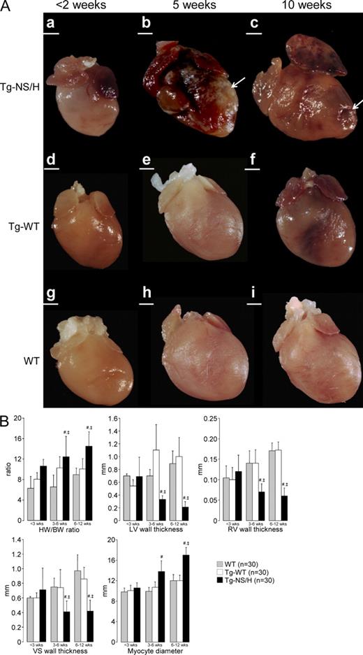 Figure 5. Gross features of explanted mouse hearts. (A) Tg-NS/H, Tg-WT, and WT hearts at age <2 (a, d, and g), 5 (b, e, and h), 10 (c, f, and i) wk. Note the structurally normal hearts at young age, with later appearance of calcification and dilatation with aneurysms (arrows) in Tg-NS/H hearts. Bars: (a, b, and d–i) 1 mm; (c) 2 mm. (B) Mean values of HW/BW ratios; LV, RV, and ventricular septum (VS) wall thicknesses; and cardiomyocyte diameters in hearts of different age groups (<3, 3–6, and 6–12 wk; 10 mice per age group for each line; #, P < 0.01 vs. WT; ‡, P < 0.01 vs. Tg-WT; Table S5).