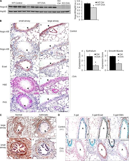 Figure 2. Regulation of Nogo-B expression during asthma-like conditions in mice and human asthma. (A) Nogo-B protein levels were significantly decreased in total lung lysates of OVA-sensitized and challenged (allergic) mice versus WT control (nonallergic) mice. Shown is a typical Western blot from six individual experiments. Nogo-B levels were quantified by densitometry and normalized to hsp90 (*, P < 0.05). Data are expressed as mean ± SEM. n = 4–7 mice per group. (B) Lung sections from representative small and large airways of untreated (control, a and b) and OVA-challenged (c and d) WT mice stained with Nogo-A/B antibody. Brown indicates positive Nogo-A/B in airway epithelium (arrowheads), smooth muscle and vessels (asterisk) of control mice, and the loss of Nogo immunoreactivity in epithelium and smooth muscle, but not vessels (*, c and d), of OVA-challenged mice. Bar, 100 µm. The graph on the right depicts quantification of Nogo-A/B staining with multiple sections from multiple mice using the scoring system, where 3 is 100% positive staining and 0 is an absence of staining (*, P < 0.01). Data are expressed as the mean ± SEM. n = 4–8 mice for both groups and data are representative of three experiments. Serial sections were stained with E-cadherin (e and f), H&E (g and h), and PAS (i and j). (C) Representative images of large (a and b) and small (c and d) airways from human lung sections of normal and fatal asthmatic specimens stained for Nogo with the N-18 antibody. Airway epithelium is indicated with arrowheads and vessels with asterisks. Bars: (top) 200 µm; (bottom) 100 µm. Images are representative of four individual normal human lung specimens and one individual fatal asthmatic specimen, with additional patient samples in Fig. S2. (D) Lung sections from control (top) and OVA-treated (bottom) Nogo-A/B+/− LacZ mice stained for β-gal. Airways (both E-cadherin and SMA positive) are indicated with A and vessels (SMA positive only) are indicated with V. Bars, 100 µm. Images represent results obtained from three individual experiments where n = 6 mice.