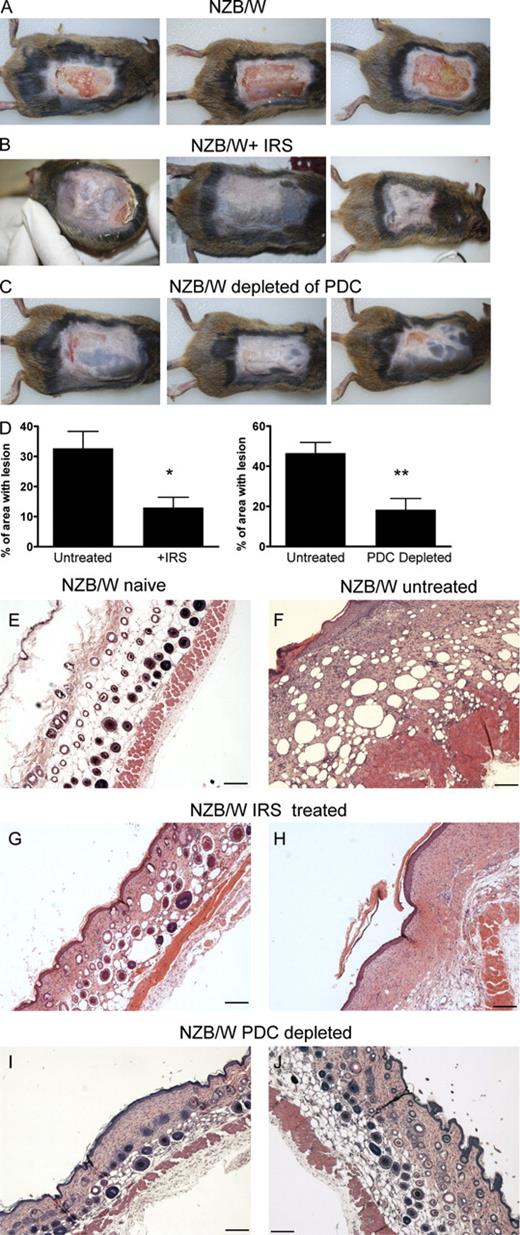 Figure 6. PDCs and TLR7 and TLR9 signaling are required for cutaneous disease formation in lupus-prone mice. (A–C) Macroscopical skin lesions 15–23 d after tape stripping in (NZBxNZW)F1 mice (A), (NZBxNZW)F1 treated with weekly injection of IRS 954 (B), and (NZBxNZW)F1 mice in which PDCs were depleted during the course of the experiment (C; see Fig. S8). (D) Quantification of area with open lesions 15–23 d after tape stripping in mice as in A–C. Cumulative data from at least two independent experiments (n = 12; mean ± SEM; *, P ≤ 0.05; **, P ≤ 0.01) are shown. (E–J) Representative sections of skin from untouched (NZBxNZW)F1 mice (naive; E) or from skin isolated 15–23 d after tape stripping from (NZBxNZW)F1 mice left untreated (F) or treated with IRS 954 (G and H) or depleted of PDCs (I and J). Representative sections from ∼15 mice are shown. Bars, 200 µm.