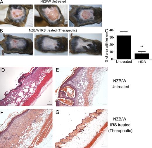 Figure 7. Therapeutic treatment of lupus-prone mice with chronic skin inflammation using IRS 954 significantly ameliorates CLE-like phenotype. (A and B) Gross appearance of skin lesions isolated 15–23 d after tape stripping from (NZBxNZW)F1 mice left untreated or (NZBxNZW)F1 mice treated from day 4–20 with IRS 954 in a therapeutic setting (scheme of treatment in Fig. S8). (C) Quantification of area with open lesions 15–23 d after tape stripping in mice as in A and B. Cumulative data from two independent experiments (n = 12; mean ± SEM; **, P ≤ 0.01) are shown. (D–G) Representative sections of skin from (NZBxNZW)F1 mice either left untreated (D and E) or treated from day 4 with IRS 954 (F and G). Data show representative sections of ∼12 mice. Bars, 200 µm.