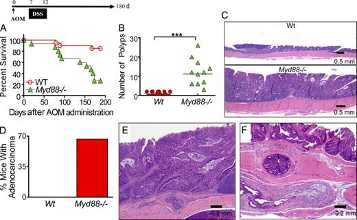 Figure 5. AOM/DSS treatment induces increased frequency of colonic adenocarcinomas in Myd88−/− mice. Cohorts of 15 Myd88−/− mice and 20 WT mice were injected i.v. with AOM on day 0 followed by a single DSS cycle. Animals were monitored during 6 mo after treatment for survival (P = 0.0005, WT vs. Myd88−/−; A). All the colons were analyzed for polyps when mice reached any of the end points for euthanasia or at the completion of the experiment (***, P < 0.001; B). Colon sections were fixed and stained with hematoxylin-eosin. 17 polyps from the WT group and 52 polyps from Myd88−/− knockout mice were analyzed histologically. Photomicrographs of representative sections from the respective groups are shown at 20× (C). The percentage of mice developing adenocarcinomas is indicated (D). Photomicrographs of representative adenocarcinomas from multiple of those that developed in Myd88−/− mice are shown at 40× magnification (E–G). The data shown in this figure were obtained from a single experiment performed treating the mice with one DSS cycle but closely mimic the data obtained from two other independent experiments with mice treated with two DSS cycles that are shown in Fig. S1.
