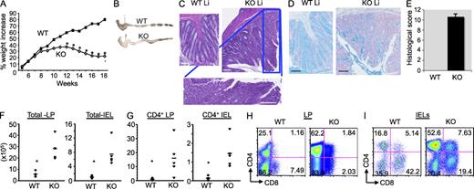 Figure 1. Bcl11bF/F/CD4-Cre mice develop wasting disease, caused by IBD, associated with massive infiltrations of CD4+ T cells in the colon. (A) Weights of Bcl11bF/F/CD4-Cre and WT mice were recorded starting at 4 wk of age (n = 6 mice per group). Asterisks indicate statistical significance determined by unpaired two-tailed Student’s t test (*, P < 0.05). (B) Representative colon gross anatomy of Bcl11bF/F/CD4-Cre and WT mice 12–16 wk of age. (C) Representative H&E staining of colon sections of a similar area along the length of the colon from Bcl11bF/F/CD4-Cre and age- and sex-matched WT mice at 15–16 wk of age. The bottom panel shows a higher magnification image of the marked areas in the KO section. (D) Alcian blue counterstained with Nuclear Fast red of colon sections from Bcl11bF/F/CD4-Cre and WT mice, indicating in blue mucus-producing goblet cells. Bars, 100 µm. (B–D) Data are representative of at least 10 pairs of mice. (E) Histological scores of colitis at 15–16 wk of age, using the criteria described in Table S1. P (evaluated by unpaired two-tailed Student’s t test) = 4.52 × 10−8. The error bar indicates SD. (F) Absolute numbers of total cells in the colon LP and epithelium (IEL) of Bcl11bF/F/CD4-Cre versus WT mice. (G) Absolute numbers of CD4+ T cells present in the colon LP and epithelial compartment (IEL). (F and G) Asterisks indicate statistical significance as determined by unpaired two-tailed Student’s t test (*, P < 0.05). Horizontal bars indicate the mean. (H and I) Frequencies of CD4+ and CD8+ T cells among the colon LP lymphocytes (H) and IELs (I) evaluated by flow cytometry. (E–I) Data are derived from four to five mice per group.
