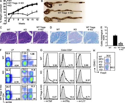Figure 5. Provision of WT Treg cells prevents IBD development in Bcl11bF/F/CD4-Cre mice. (A) Sorted WT Foxp3-GFP+ Treg cells were transferred into 4–5-wk-old Bcl11bF/F/CD4-Cre mice, as described in Materials and methods, and the weight of the mice was assessed weekly. Asterisks indicate statistical significance between the Treg cell transferred and untransferred groups (*, P < 0.05; determined by unpaired two-tailed Student’s t test). (B) Colon gross anatomy of Bcl11bF/F/CD4-Cre (KO), WT Treg cell–transferred Bcl11bF/F/CD4-Cre (WT Tregs → KO), and WT mice. (C) H&E staining of colon sections from the mice in B. (D) Alcian blue counterstained with Nuclear Fast red of colon sections from the mice in B. Goblet cells are blue. (C and D) Histological images are from similar areas along the length of the colon of the three groups of mice. Bars, 100 µm. (E) Histological scores of colitis, conducted as described in Table S1. (P < 0.05, determined by unpaired two-tailed Student’s t test.) Error bars indicate SD. (F) CD4+ and CD8+ T cell frequencies within the total lymphocyte population isolated from colon LP and epithelial compartment (IEL). (A–F) Data are representative of two independent experiments with three to five mice per group. (G) Intracellular cytokines in gated CD4+ T cells isolated from the colon of the indicated groups of mice. (H) Sorted WT CD45.1+/CD45.2+/Foxp3-GFP+ Treg cells were transferred into Bcl11bF/F/CD4-Cre/CD45.2+ mice, and WT (CD45.1+) and Bcl11b-deficient (CD45.1−) cells were evaluated 6–7 wk after the transfer. Splenocytes were stained for CD4, CD45.1, and Foxp3 and analyzed by flow cytometry. Numbers in boxes indicate the frequencies of the donor (CD45.1+) and recipient (CD45.1−) cells within the Foxp3+ population. Foxp3 mean fluorescence intensity (MFI) in Bcl11b-deficient and WT cells is indicated. (G and H) Data are representative of three independent experiments each with two to three mice per group.