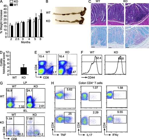 Figure 6. Bcl11bF/F/Foxp3-Cre mice fail to gain weight only after 20 wk of age and show colon inflammation with infiltration of proinflammatory cytokine–producing CD4+ T cells. (A) Weight of Bcl11bF/F/Foxp3-Cre mice between 2 and 6 mo of age. 6–10 mice/group were evaluated. Asterisks indicate statistical significance determined by unpaired two-tailed Student’s t test (*, P < 0.05). (B) Colon gross anatomy representative for 5–6-mo-old Bcl11bF/F/Foxp3-Cre mice and age-matched controls. (C) H&E staining (top) and Alcian blue counterstained with Nuclear Fast red (bottom) of colon sections of 5–6-mo-old Bcl11bF/F/Foxp3-Cre and age-matched controls. Goblet cells are blue. Histological images are from similar areas along the length of the colon. Bars, 100 µm. (B and C) Data are representative of five pairs of mice. (D) Colitis histological scale of 5–6-mo-old Bcl11bF/F/Foxp3-Cre and age-matched controls, using the criteria in Table S1. (A and D) Error bars indicate SD. (E) Frequencies of CD4+ and CD8+ T cells in spleen of Bcl11bF/F/Foxp3-Cre and WT mice. (F) Frequencies of CD44+CD4+ T cells in spleen of Bcl11bF/F/Foxp3-Cre and WT mice. Data are representative of three pairs of mice. (G) Frequencies of CD4+ and CD8+ T cells in the colon LP and intraepithelial compartment (IEL) of Bcl11bF/F/Foxp3-Cre and WT mice. (H) Cytokine production by CD4+ T cells isolated from Bcl11bF/F/Foxp3-Cre and WT mice colons. Cells were isolated and activated as described in Materials and methods, followed by staining for surface CD4 and intracellularly for the indicated cytokines, and analyzed by flow cytometry. Frequencies of cytokine-producing CD4+ T cells are indicated. Data are representative of three pairs of mice.