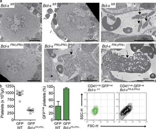 Figure 5. Platelet production is abnormal in the absence of Bcl-xL. (a) Representative transmission electron microscope images of BM sections showing aberrant MGK morphology and abortive platelet shedding in Bcl-xPf4Δ/Pf4Δ mice. Arrows indicate normal platelets in wild-type and large megakaryocyte-derived fragments in Bcl-xPf4Δ/Pf4Δ animals. Red blood cell (R). Bars: 5 or 10 µm, as indicated. See Fig. S3 for higher magnification images. (b) Mice reconstituted with a 50:50 mixture of Bcl-xPf4Δ/Pf4Δ and wild-type GFP-expressing BMCs. (left) Platelet counts in peripheral blood 7 wk after transplant, mean ± SEM. (middle) Percent CD41+ve GFP+ve platelets; mean ± SD. n = 6. (right) Flow cytometric forward and side scatter plots of CD41+ve platelets in PRP. In these mice, GFP+ve platelets were produced by wild-type MGKs, GFP−ve platelets by Bcl-xPf4Δ/Pf4Δ MGKs. Plots are representative of n = 6 recipient mice per transplant group.