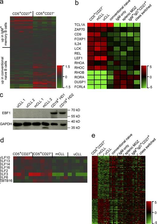 Figure 5. Evaluation of CD5+ B cell and CLL gene expression profiles. (a) Heatmap of CD5+ B cell subset transcription patterns of genes with differential expression between conventional naive and IgM+ memory B cells (Table S9). The color bar depicts normalized intensity values. (b) Heatmap of selected genes with similar transcription in CD5+ B cells and CLL (Table S11). (c) Immunoblotting of EBF1. Protein lysates of CLL and CD19+ B cells from healthy donors were analyzed for EBF1 and GAPDH content. Data are representative of 10 CLL analyzed. (d) Expression heatmap of selected KLF family members in CLL and CD5+ B cells. GEP of normal CD5+ B cell subsets and CLL were filtered for KLF family members with differential expression within the four cell types (Table S12). Depicted are normalized signal intensities. (e) Differentially expressed transcripts (>twofold-change; P < 0.05; FDR < 0.05) between uCLL and CD5+CD27− B cells (HG U133 array), but not (<twofold change; P < 0.05; FDR < 0.05) between uCLL and bulk conventional B cells (naive and memory B cells combined). All transcripts in this list (Table S14) are considered as deregulated genes in CLL that were not detectable (or underestimated) in analyses including conventional CD19+ B cells. Normalized signal intensities are shown.