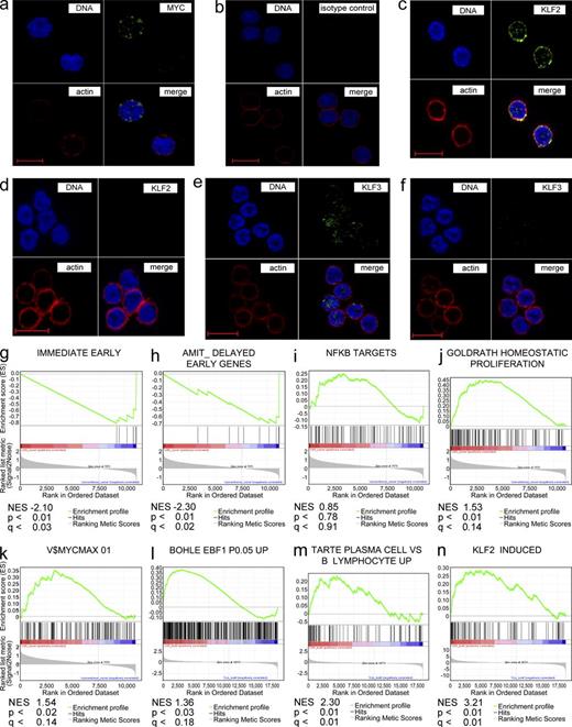 Figure 6. Fluorescence microscopic analysis and GSEA of CD5+ B cells and CLL. CD5+ B cells and CLL cells were stained for intracellular MYC, KLF2, or KLF3 expression (green). DNA and actin were stained with Hoechst 33258 (blue) and Phalloidin-TRITC (red), respectively. MYC was expressed in <1% of CD5+ B cells (a), as compared with isotype negative control stainings (b). Sporadic KLF2 expression was detectable in CD5+ B cells (c) but never in CLL (d). KLF3 was expressed in 28–40% of CD5+ B cells (e) and in 1–5% of CLL cells (f) as determined by two independent blind studies of two normal CD5+ B cell samples and two CLL each (Table S13). Pictures are representative of four healthy donors and five CLL analyzed. (g–n) shows selected plots from a GSEA based on 24,000 probe sets of 5 CD5+CD27− and 5 CD5+CD527+ B cell GEP combined with 7 conventional naive B cell GEP or 9 CLL GEP, irrespective of the mutation status. Normalized enrichment score (NES), nominal p-value (p), and FDR (q) are given for each plot. (g–k) CD5+CD27− B cells are shown on the left side (red) of the plots, conventional naive B cells on the right side (blue). (g) Immediate early genes, (h) delayed early genes, (i) NF-κB target genes, (j) homeostatic proliferation genes, (k) MYC/MAX target genes. (l–n) pools of CD5+ B cell subsets are shown on the left side (red), CLL on the right side (blue). (l) EBF1 target genes, (m) genes up-regulated in plasma cells versus B cells, (n) KLF2-induced genes.
