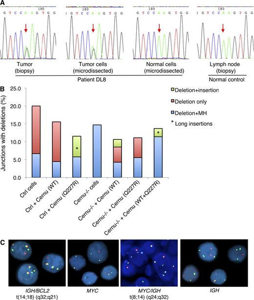 Figure 3. Novel mutation identified in the Cernunnos gene in a DLBCL sample (DL8). (A) Somatically acquired mutation in Cernunnos in tumor cells. The missense mutation (c.680A>G, p.Q227R; indicated by red arrows) was found in a heterozygous form in DNA prepared from the tumor biopsy or microdissected tumor cells but not in microdissected normal cells, nor in controls. The microdissection experiment was performed once, whereas the sequencing was performed on both directions, and the result from the forward direction is shown in the figure. (B) Functional characterization of the p.Q227R mutant using a plasmid-based NHEJ assay. The proportion (%) of different types of end-joining junctions associated with deletions, summarized from three independent experiments, is plotted. A summary of all types of junctions is shown in Table S1. Ctrl, control; Cernu, Cernunnos; MH, microhomology. (C) Detection of chromosomal translocations in tumor cells by FISH assays. IGH/BCL2 (first panel) and MYC/IGH rearrangements (third panel) were identified as orange/green (yellow) fusion signals. MYC (second panel) and IGH (fourth panel) rearrangements were identified as red and green splitting signals. The first panel is based on two independent experiments, whereas the remaining three are based on one experiment. Within each experiment, at least 100 intact, nonoverlapping nuclei were scored for each probe, and representative results are depicted.