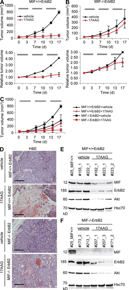 Figure 7. Hsp90 inhibition via systemic 17AAG treatment induces marked growth inhibition in MIF+/+ErbB2 tumors but shows no impact in MIF−/−ErbB2 tumors. (A–C) Median tumor volumes in response to treatment. Time course is in days (d). Mice with small comparably sized breast tumors (mostly <50 mm3; A and B, top) and larger tumors (mostly >200 mm3; A and B, bottom) of MIF+/+ErbB2 (A) and MIF−/−ErbB2 (B) genotypes were treated with intraperitoneal injections of 17AAG (red lines) or vehicle (EPL diluent, black lines) 5 d per week for 3 wk. Horizontal gray bars indicate the time windows of daily 17AAG treatments. During treatment, tumor sizes were monitored twice a week. Top, for small tumors, four independent experiments for treatment/genotype combinations were performed on different days in a total of 22 mice (seven mice in experiment 1; five mice in experiment 2; four mice in experiment 3; and six mice in experiment 4). MIF+/+ErbB2 + vehicle: 5 tumors in 4 mice; MIF+/+ErbB2 + 17AAG: 8 tumors in 5 mice; MIF−/−ErbB2 + vehicle: 9 tumors in 5 mice; MIF−/−ErbB2 + 17AAG: 16 tumors in 8 mice. Each independent experiment was done side by side for all treatment/genotype combinations. For clarity, data are shown separately in A (MIF+/+ErbB2) and B (MIF−/−ErbB2). Overlay of both genotypes is graphed in C. For detailed listing of all small tumors, see Fig. S1. Bottom, larger tumors (mostly > 200 mm3) were analyzed in one experiment side by side in a total of eight mice. For clarity, treatment/genotype combinations are shown separately in A (MIF+/+ErbB2) and B (MIF−/−ErbB2). The response rates of the larger tumors were normalized to their respective starting tumor volumes. As expected, vehicle-treated small and large control tumors showed a similar tumor progression (compare black lines, top and bottom). MIF+/+ErbB2 + vehicle: one tumor in one mouse. MIF+/+ErbB2 + 17AAG: three tumors in three mice. MIF−/−ErbB2 + vehicle: one tumor in one mouse. MIF−/−ErbB2 + 17AAG: three tumors in three mice. For detailed listing of all larger tumors, see Fig. S2. Error bars indicate the SDs of all tumors measured per treatment/genotype combination. (D) Tumors from MIF+/+ErbB2 and MIF−/−ErbB2 mice treated with intraperitoneal 17AAG or vehicle were stained by H&E. Bars, 100 µm. (E and F) Mice were sacrificed 8 h after the final dose of intraperitoneal 17AAG or vehicle on day 17 (see A–C) and breast tumors were harvested. Lysates of MIF+/+ErbB2 (E) and MIF−/−ErbB2 tumors (F) treated with 17AAG or vehicle (EPL) were immunoblotted. Effective inhibition of Hsp90 by 17AAG was confirmed by degradation of MIF, ErbB2, and Akt. Hcs70, loading control. Each number indicates a different mouse. Tumor #25 served as reference tumor also used in Figs. 1 B and 6 D.