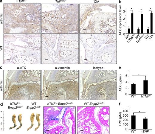 Figure 2. Increased ATX expression in mouse arthritic joints in vivo. (a) Representative immunohistochemistry images showing the expression of ATX in inflamed joints of three animal models of arthritis and respective WT littermate controls. Identical ATX staining was obtained in sequential sections (Fig. S1 a) and with different anti-ATX Abs (Fig. S1, b and c). (b) Quantification of ATX expression in mouse synovial tissues, as seen in a, was performed as described in Materials and methods (hTNF+/−, n = 10; TnfΔARE/+ and CIA, n = 3). (c) Immunostaining of ATX (and its isotype control) or vimentin in sequential sections of mouse synovial tissues. (d) Representative whole mount X-gal staining (left) and X-gal staining on joint sections (right) from WT and hTNF+/− mice carrying one genetically modified allele driving LacZ expression under the control of the ATX promoter (n = 3). (e) Plasma levels of ATX in littermate pairs of WT and hTNF+/− mice at the time of sacrifice (n = 10; litters = 4). (f) Measurement of (total) LPC plasma levels with LC/MS in WT and hTNF+/− mice at the time of sacrifice (n = 9; litters = 2). (b, e, and f) Mean ± SE is shown. *, P < 0.05. Bars, 50 µm.