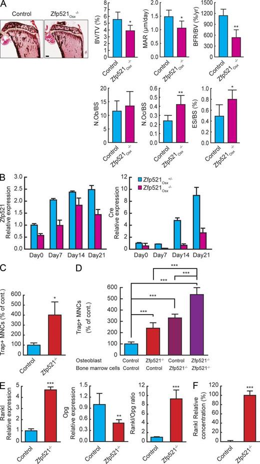 Figure 3. Zfp521 controls OB-dependent OC-genesis. (A) Von Kossa staining and histomorphometric analysis of tibia sections in 6-wk-old Zfp521Osx−/− mice and littermate controls (n = 6–8). N.Ob, number of OBs; N.Oc, number of OCs; TV, tissue volume. Bar, 520 μm. (B) Calvarial cells from Zfp521Osx−/− and control newborn mice were harvested and cultured on 6-well plates in OM. RNA was extracted at the indicated times, and Zfp521 and Osx-Cre expression were measured by qRT-PCR. (C) Total BM cells from Zfp521−/− and control mice were plated on 48-well plates, stimulated with 10 nM hPTH(1–34), and stained for TRAP. Number of TRAP+ multinucleated cells (MNCs) per well is shown. (D) Calvarial and nonadherent BM cells from control and Zfp521−/− mice were mixed as indicated in 24-well plates, stimulated with vitD3 and PGE2, and stained for TRAP. Bar graphs indicate the number of TRAP+ multinucleated cells per well. (E) RNA was extracted from the co-culture experiment in D, and the mRNA expression of Rankl and Opg and the Rankl/Opg ratio were quantified using qRT-PCR. (F) Control and Zfp521−/− calvarial cells were cultured in 24-well plates and stimulated with vitD3 and PGE2 as in co-culture experiments. RANKL concentration in the controls was below detection limit (n = 3). All data are means ± SD. Similar cell number and mRNA data were obtained from at least three experiments with three to six replicates per condition. *, P < 0.05; **, P < 0.01; ***, P < 0.001. See also Table S4.