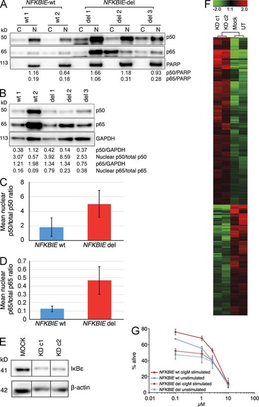 Figure 5. Functional analysis of the NFKBIE deletion in CLL. (A) Cytoplasmic (C) and nuclear (N) expression of p50, p65, and PARP in CLL patients. For the nuclear fraction, the expression ratio to PARP is provided. (B) Expression levels for p50, p65, and GAPDH in TCLs for the same patient. Normalized nuclear expression for p50 and p65 is provided. (C and D) Mean normalized nuclear expression of p50 (C) and p65 (D) in CLL. Error bars indicate standard error. (E) Western blot showing IκBε expression for the mock-transfected cells as well as the two independent knockdown clones (KD c1 and c2) in the HG3 cell line. All samples were run on the same gel but not in adjacent lanes and have therefore been quantified using the same exposure time. (F) Gene expression patterns in two independent CLL HG3 cell lines (c1 and c2) with partial knockdown (KD) of IκBε compared with the mock-transfected and untransfected (UT) HG3 cell lines. Genes that showed at least 50% difference in both c1 and c2 compared with either Mock or UT were selected. The list of genes is provided in Table S12. (G) Dose–response curves to the BTK inhibitor ibrutinib in primary CLL samples with WT NFKBIE (n = 4) and deleted NFKBIE (n = 4). Data were normalized against ibrutinib-naive CLL cells in culture. In NFKBIE WT cases, borderline significance was observed when comparing αIgM-stimulated versus unstimulated cells (P = 0.07 at 0.1 µM concentration, P = 0.06 at 1 µM concentration, and P = 0.05 at 2.5 µM concentration). Error bars indicate standard error.