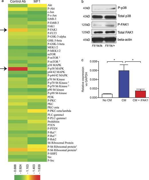 Figure 8. FLT1-regulated CSF1 expression through p-FAK1. (a) Efficacy of FLT1 blockade using MF1 antibody against a panel of 45 proteins and phosphor-proteins on a reverse protein array. Color bar shows relative expression value (global normalization, refer to Table S1 for epitope information). Phosphorylation of p38 and FAK1 show the most notable reduction upon FLT1 blockade using MF1 antibody. n = 2. (b) Western blot showing inhibition of phosphor-p38 and phosphor-FAK1 in BMMs from littermate mice heterozygous or homozygous for Flt1tk. Representative blot from two independent experiments. (c) FAK1 inhibitor blocks tumor cell–conditioned medium (CM)–induced mRNA Csf1 expression in BMMs. Data show mean + SEM. n = 3; *, P < 0.05 by ANOVA plus Dunnett’s multiple comparison test.