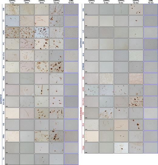 Figure 3. Injection of mPFFs in the OB induced widespread α-syn pathology (Pser129) in the brain. Pathology (Pser129) detected in numerous brain regions from 1 to 12 mo after injection of mPFFs in ipsilateral (Ipsi) and contralateral (Contra) structures. Histochemical analysis was performed on all animals from the 1-, 3-, 6-, 12-mo survival time points. The sections were immunostained in eight independent histochemical experiments. n = 4–5 animals per group. The data shown are from representative animals. List of abbreviations is available in Table S3. Bars: 20 µm.