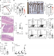 T cell–intrinsic caspase-1 is required for Th17-mediated colitis.(A) Weight change of Rag1−/− mice that received WT, Casp1Δ10, or Il1b−/− naive CD4 T cells (CD45RBhi) at indicated time points (n = 6–10 mice for each group). NT, nontransferred (i.p. PBS). (B) Percentage of initial body weight 4 wk after transfer. n = 12–19 mice per group. (C) Representative image of colons (left) and measured colon length (right) of Rag1−/− mice at 4–5 wk after transfer. n = 4–8 mice per group. (D) Representative H&E staining of colon sections from NT, WT, or Casp1Δ10 (Δ10) naive T cell–transferred Rag1−/− mice (left) and histology score (right). Images are displayed at 20× magnification. Ruler bar represents 100 µm. n = 12–14 mice per group. (E) Representative flow plots showing the percentages of IL-17A+IFNγ+ of CD4+CD90+CD44+ T cells in the mLNs or colonic LP (Colon-LPL) of Rag1−/− mice 4 wk after transfer of WT or Casp1Δ10 (Δ10) naive CD4 T cells. n = 8–13 mice per group. (F) The number of CD4+CD90+IL-17A+ T cells in the spleens of the Rag1−/− mice that received WT or Casp1Δ10 (Δ10) naive CD4 T cells. n = 6 per group. (G) Serum IL-17A levels at the indicated time points from the mice in Fig. 5 F. n = 5 mice per group. Data are representative of or combined from two to four independent experiments. Each data point represents one biological replicate. Statistics represent mean ± SEM and P values were determined by two-way repeated ANOVA with Bonferroni correction (A), one-way ANOVA (B and C), Mann-Whitney U test (D), unpaired Student’s t test (E and F) or multiple t tests with Holm-Sidak correction (G). *, P < 0.05; **, P < 0.01; ***, P < 0.001; ****, P < 0.0001.