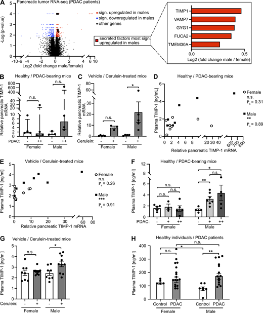 Male-biased pancreatic TIMP1 expression is associated with a male-specific increase of TIMP1 plasma levels in pancreatic disease.(A) Volcano plot (left) of transcriptomic data showing sex-dependent gene expression in PancT tissue of female (n = 33) and male (n = 34) PDAC patients. The Mann-Whitney test was employed to calculate P values. Genes were considered to be significantly (sign.) up-regulated (red) or down-regulated (blue) in males after Benjamini-Hochberg adjustment (see also Table S2). Median male versus female fold change expression of genes encoding for secreted factors most significantly up-regulated in males (right). (B and C) Relative pancreatic TIMP1 mRNA expression in healthy female (n = 4) or male (n = 3) mice as well as in PDAC-afflicted female (n = 4) and male (n = 4) KPC mice (−: control mice; ++: advanced PC; B) or in mice treated with (+, female: n = 3; male: n = 5) or without (−, female: n = 5; male: n = 4) cerulein (C), respectively. The Mann-Whitney test (B) and Student’s t test (C) were employed for statistics, respectively. Up-regulation of TIMP1 expression in male KPC mice was close to significant (P = 0.057). Median ± interquartile range (B and C). (D and E) Correlation of relative pancreatic TIMP1 mRNA expression with TIMP1 plasma levels in female (n = 8) or male (n = 7) KPC mice (D) or in female (n = 8) or male (n = 9) mice of the cerulein-based mouse model (E). Spearman’s correlation was employed for statistics. (F) Plasma TIMP1 levels of female (n = 5) and male (n = 5) healthy control or female (+: n = 3; ++: n = 5) and male (+: n = 7; ++: n = 5) KPC mice (−: control mice; +: early PancTs; ++: advanced PC). Student’s t test was employed for statistics. Mean ± SEM. (G) Plasma TIMP1 levels of female and male mice treated with (+, female: n = 9; male: n = 10) or without (−, female: n = 8; male: n = 8) cerulein. Student’s t test was employed for statistics. Mean ± SEM. Data were derived from at least three independent cerulein-based mouse experiments (C, E, and G). (H) Plasma TIMP1 levels of female (n = 5) and male (n = 7) healthy control subjects or female (n = 17) and male (n = 14) patients with PDAC (UICC stages I and II). Student’s t test was employed for statistics. Median ± SEM; *, P ≤ 0.05; **, P ≤ 0.01; ***, P ≤ 0.001 (B–H).