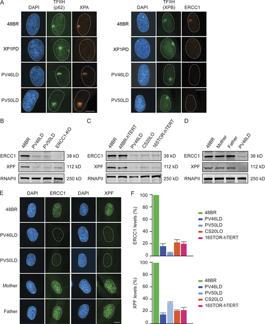 Patient fibroblasts have low ERCC1 and XPF protein levels.(A) Representative microscopy images of different antibody stainings after local UV-C irradiation. Quantification of these data is shown in Fig. S3 D. (B–D) Western blot of the indicated cell lines stained for ERCC1 and XPF. Additional Western blot data are shown in Fig. S3, E and F. (E and F) Microscopy images (E) and quantification of the ERCC1 and XPF protein levels based on Western blot (F) in the indicated cell lines. Data represent mean ± SEM. Scale bar is 5 µm. Uncropped Western blot data are shown in Data S1. Refer to the image caption for details.