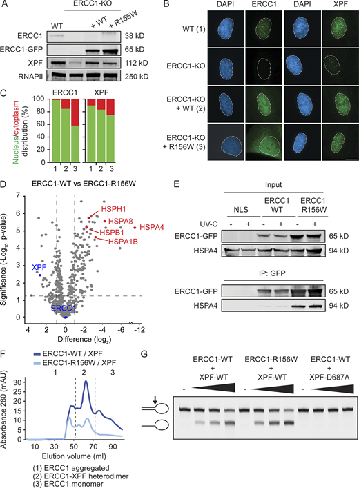 The ERCC1R156W substitution causes partial cytoplasmic localization.(A) Western blot of U2OS WT, ERCC1-KO, and ERCC1-KO complemented with either ERCC1WT or ERCC1R156W. (B and C) Microscopy images (B) and nuclear/cytoplasmic distribution (C) of ERCC1 and XPF in complemented U2OS cells. (D) Volcano plot depicting the differential interactome of ERCC1WT over ERCC1R156W after pull-down and analysis by label-free MS. The enrichment (log2) is plotted on the x axis, and the significance (−log10 P value) is plotted on the y axis. The dashed lines indicate an enrichment of twofold on the x axis (log2 of 1) and a significance of 0.05 (−log10 P value of 1.3) on the y axis. Note that interactors in red bind more strongly to ERCC1R156W than to ERCC1WT. (E) Co-IP of GFP-NLS, ERCC1WT-GFP, and ERCC1R156W-GFP in the absence or presence of UV-C. (F) Gel-filtration profiles of recombinant purified ERCC1WT-XPF or ERCC1R156W-XPF in mega-arbitrary units (mAU). The dashed lines indicate the approximate volumes at which aggregated ERCC1 (<50 ml), ERCC1-XPF heterodimer (50–70 ml), and ERCC1 monomer (>70 ml) elute. See Fig. S4 C for additional data. (G) Nuclease activity assay of ERCC1WT-XPF or ERCC1R156W-XPF on a stem-loop DNA substrate. Scale bar is 5 µm. The number of cells used for quantification is shown in Table S6. Uncropped Western blot data are shown in Data S1. Refer to the image caption for details.