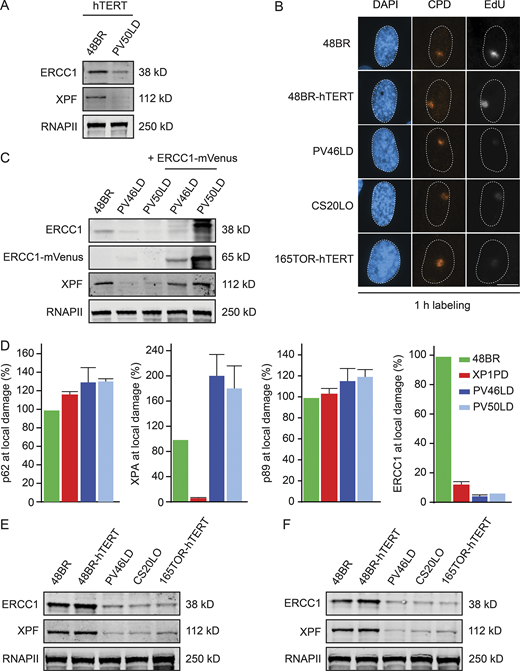 ERCC1 protein expression in patient fibroblasts.(A) Western blot of hTERT-immortalized 48BR and PV50LD cells. (B) Representative microscopy images of UDS in the indicated cell lines. (C) Western blot on 48BR and the patient fibroblasts with or without lentiviral transduction with ERCC1-mVenus. Note that the decreased protein levels of XPF are fully reversed. (D) Quantification of local damage staining shown in Fig. 3 A. Data represent mean ± SEM. (E and F) Western blot of the indicated cell lines stained for ERCC1 and XPF (n = 2). Scale bar is 5 µm. The number of cells used for quantification is shown in Table S6. Uncropped Western blot data are shown in Data S1. CPD, cyclobutane pyrimidine dimer.