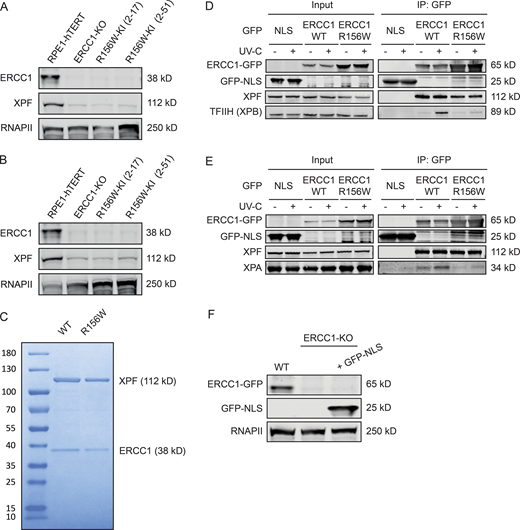 Co-IP of ERCC1WT-GFP and ERCC1R156W-GFP.(A and B) Western blot of the indicated RPE1 cell lines stained for ERCC1 and XPF. (C) Purified recombinant XPF-HA-ERCC1WT-His and XPF-HA-ERCC1R156W-His proteins. (D and E) Co-IP of U2OS GFP-NLS, ERCC1WT-GFP, and ERCC1R156W-GFP in the absence or presence of UV-C showing the UV-induced interaction with TFIIH (D) or XPA (E). The panel in Fig. 6 C is a composite based on these individual Co-IPs. (F) Western blot of the indicated U2OS cell lines stained for ERCC1 and GFP. Uncropped Western blot data are shown in Data S1. CPD, cyclobutane pyrimidine dimer. Refer to the image caption for details.