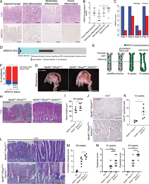 Promotion of gastric tumor progression by Arid1a heterozygosity. (A) Histological images and ARID1A staining of human GC samples with different tumor grades. Scale bars, 100 µm. (B) Quantification of ARID1A protein level using ARID1A staining of human GC samples with different tumor grades (*, P = 0.048). Bars represent mean ± SEM. (C) Quantification of ARID1A protein level from ARID1A staining between tumor and adjacent benign tissues in the same tumor-normal pairs. (D) Summary of ARID1A alterations found in human GC patients using DNA-sequencing data obtained from TCGA (STAD, Firehose) and visualized using cBioportal OncoPrint (Cerami et al., 2012; Gao et al., 2013). Among the 54% of all GC samples that exhibit ARID1A mutations, the majority of ARID1A alterations (87%) are functionally heterozygous, occurring either as a single truncation mutation (in black) or as a shallow deletion (in light blue). (E) Diagram outlining adenoma formation in the Notch-driven gastric adenoma model. NICD, Notch1 intracellular domain. (F) Analysis of TCGA-STAD data showing the proportion of ARID1A wild-type or ARID1A heterozygous GC samples that contain amplification for genes related to Notch signaling (*, P = 0.026, χ2 test). (G) Whole-mount images of the gastric lumen comparing Arid1a heterozygous adenoma mice with adenoma mice with intact Arid1a, showing larger tumors in the former (n = 5 each). Scale bars, 5 mm. (H) Representative histological images of Arid1a intact and Arid1a heterozygous gastric adenoma at an early stage of tumor progression (n = 6–8 each). Scale bars, 100 µm. Bars represent mean ± SEM. (I) Quantification of gastric gland height confirms a significant increase in gland height of Arid1a heterozygous tumors compared with Arid1a intact tumors at initial stages of tumor progression (*, P = 0.045, unpaired t test). (J) Representative images of Ki67 staining, a marker of proliferating cells, in Arid1a intact and Arid1a heterozygous tumors at 10 wk (n = 4–5 each). Scale bars, 100 µm. (K) Quantification of Ki67+ cells in the epithelium of Arid1a intact and Arid1a heterozygous tumors at 10 wk (*, P = 0.024, unpaired t test). Bars represent mean ± SEM. (L) Representative histological images of Arid1a intact and Arid1a heterozygous gastric adenoma at late stage (25 wk) of tumor progression (n = 5–6 each). Scale bars, 100 µm. (M) Histopathological scoring of late-stage tumors shows a significant increase in the cumulative disease score of Arid1a heterozygous tumors compared with Arid1a intact tumors using features shown in Table S1 (*, P = 0.028, unpaired t test). Bars represent mean ± SEM. (N) Histopathological scoring of dysplasia using features shown in Table S1 indicates no significant difference between Arid11a intact and heterozygous tumors at an early stage. At late stages, Arid1a heterozygous tumors have a significantly higher dysplastic index than Arid1a intact tumors (*, P < 0.05; ***, P < 0.001; unpaired t test). Bars represent mean ± SEM.
