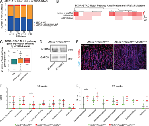 ARID1A heterozygous loss promotes tumor progression in Notch-activated gastric adenoma. (A) Analysis of ARID1A alterations in different human GC stages based on data obtained from TCGA (STAD, Firehose) identifies an increased proportion of ARID1A heterozygous alterations in the more advanced stages. TNM, tumor, node, metastasis. (B) Analysis of TCGA-STAD data showing the overlap of human GC cases with amplifications in Notch pathway genes and ARID1A mutations. The top row of the heatmap indicates the number of Notch pathway genes amplified, and the bottom row indicates the samples with or without ARID1A mutation. (C) Analysis of Notch pathway gene expression in human gastric cancer cases with ARID1A alterations from TCGA-STAD data shows significantly increased Notch pathway gene expression in ARID1A heterozygous cancer cases compared with ARID1A wild-type cancer cases (*, P < 0.04491, unpaired t test). (D) Western blot of ARID1A from the tumor epithelial cells of 10- and 20-wk-old Notch-activated adenoma mice. (E) Representative immunofluorescence images of ARID1A staining in Arid1a intact and Arid1a heterozygous gastric tumors demonstrate that ARID1A expression is not completely lost in Arid1a heterozygous tumors (n = 3 each). Scale bar, 100 µm. (F) Individual disease scores of 10-wk-old Arid1a intact and Arid1a heterozygous gastric tumors using Table S1 (*, P < 0.05; unpaired t test). Bars represent mean ± SD. (G) Individual disease scores of Arid1a intact and Arid1a heterozygous gastric tumors at 25 wk of age using Table S1 (*, P < 0.05; unpaired t test). Bars represent mean ± SD. Refer to the image caption for details.