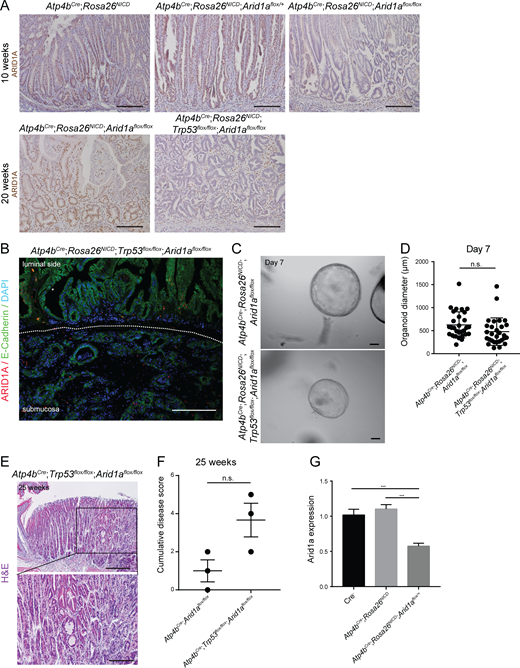 Analysis of Trp53 deletion in Arid1a homozygous tumors. (A) Representative images of ARID1A staining by histochemistry in 10-wk and 20-wk Arid1a intact, Arid1a heterozygous, and Arid1a homozygous tumors (n = 3 each). Scale bar, 100 µm. (B) Representative image of ARID1A and E-cadherin costaining in gastric tumor with double deletion of Arid1a and Trp53 (n = 3). Scale bar, 100 µm. (C) Representative images of organoids established from the epithelial cells of Arid1a homozygous tumors or Arid1a;Trp53 double-deletion tumors. Experiments were repeated twice with organoids obtained from two different mice for each genotype. Scale bars, 100 μm. (D) Quantification of the diameter of organoids established from the epithelial cells of Arid1a homozygous tumors and Arid1a;Trp53 double-deletion tumors (unpaired t test). Bars represent mean ± SD. (E) Representative histological images of stomach with double deletion of Arid1a and Trp53 in gastric parietal cells at 25 wk (n = 3). Scale bar, 100 µm. (F) Histopathological scoring of stomachs with Arid1a deletion and Arid1a;Trp53 double deletion in gastric parietal cells using features shown in Table S1 (P = 0.065, unpaired t test). Bars represent mean ± SEM. (G) RT-qPCR analysis of Arid1a expression in normal stomachs and tumor organoids on day 4 of culture confirms down-regulation of Arid1a in Arid1a heterozygous tumor organoids. Experiments were repeated at least twice with organoids obtained from two different mice for each genotype (***, P < 0.001; unpaired t test). Error bars represent SEM. Refer to the image caption for details.