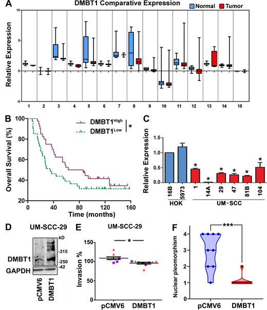 DMBT1 is down-regulated in HNSCC, and overexpression of DMBT1 suppresses invasion and tumor progression.(A) Meta-analysis showing down-regulation of DMBT1 in HNSCC relative to normal tissue. The datasets and accession numbers are given in Table S1. (B) Down-regulation of DMBT1 is correlated with poor overall survival in patients with HNSCC. The analyses were performed with the Rickman Head-Neck dataset (reporter ID, 208250_s_at; Oncomine; n = 81; *, P < 0.05; log-rank test). (C) DMBT1 gene expression in HNSCC cell lines. Total RNA from immortalized (HOK16B), primary keratinocytes (HOK5973), and HNSCC cell lines UM-SCC-(1, 14A, 29, 47, 81B, 104) was used to generate cDNAs, and Q-RT-PCR was performed. Data were analyzed by the relative quantification method with normalization to GAPDH and then relative to keratinocytes (*, P < 0.001; one-way ANOVA; error bars represent SD). Each sample was analyzed in triplicate, and the average fold-change was determined. (D) DMBT1 was stably overexpressed in UM-SCC-29 as verified by immunoblot analysis (n = 2). (E) Overexpression of DMBT1 suppresses invasion in vitro at 48 h. Each color represents an independent experiment with three replicates in each experiment (*, P < 0.05; t test). (F) Nuclear pleomorphism is significantly less in tumors with UM-SCC-29-DMBT1 cells than in control tumors with UM-SCC-29-pCMV6 cells (***, P < 0.001; t test; n = 9; error bars represent SD). Refer to the image caption for details.