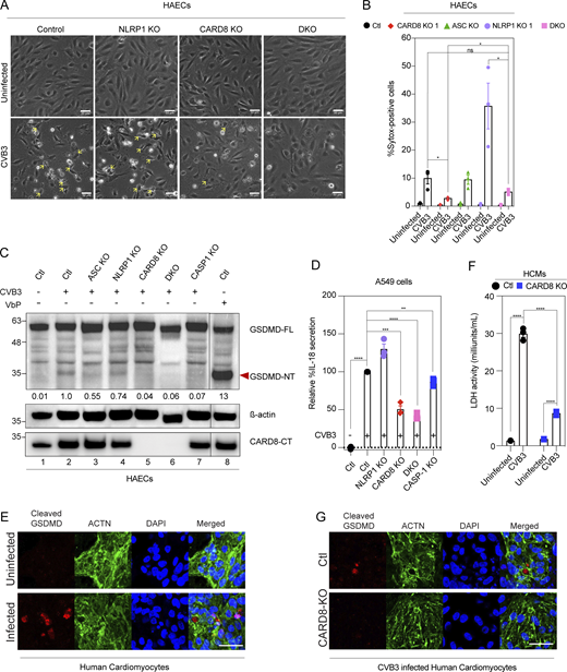 CVB3 activates the CARD8 inflammasome in endothelial cells and human cardiomyocytes. (A) Phase contrast images of HAECs of indicated genotypes 16-h post-CVB3 infection (20×). Yellow arrows highlight pyroptotic morphology. Scale bars, 50 µm. (B) Percentage SYTOX-positive HAECs of indicated genotypes 16-h post-CVB3 infection. (C) Immunoblot of HAECs infected with CVB3 for 16 h, showing levels of cleaved GSDMD with normalized densitometry values of N-terminal fragment (GSDMD-NT) with β-actin loading control. (D) Relative levels of IL-18 secreted by CVB3-infected A549 cell of indicated genotype, normalized to scrambled control (ctl). (E) Immunofluorescence of human cardiomyocytes (HCM) infected with CVB3 for 16 h, stained for cleaved GSDMD and cardiomyocyte marker ACTN. Scale bars, 50 µm. (F) Cell death as measured by LDH activity in supernatant of HCMs 16-h post-CVB3 infection. (G) Immunofluorescence of control and CARD8 KO HCM infected with CVB3 for 16 h for cleaved GSDMD and cardiomyocyte marker ACTN. Scale bars, 50 µm. Data are represented by mean ± SEM, P values indicated are from parametric, unpaired, two-tailed student’s t test. *, P < 0.05; **, P < 0.01; ***, P < 0.001; and ****, P < 0.0001. The CVB3 infection MOI used is 0.1 unless indicated otherwise. Unless otherwise stated, each dot represents a biological replicate. All experiments were repeated twice. Source data are available for this figure: SourceData F2.