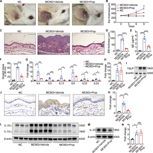 Topical propionate application attenuates MC903-induced AD-like dermatitis in mice by inhibiting IL-33 production. MC903 or MC903 plus propionate (Prop) was applied topically on the ears of BALB/c mice once a day for 9 d (n = 3–5 per group). (A) Representative gross appearance of the ears. (B) Dynamic changes in ear thickness on days 0, 3, 6, and 9. (C) H&E staining of ear sections. (D) Epidermal (EM) thickness of ear sections under high-power magnification. (E) Total serum IgE. (F) Scratching frequency. (G) mRNA expression of various cytokines in the ears of mice from each group. (H and I) Expression of TSLP mRNA and protein in the ears. (J–L) The expression of IL-33 in the ears of mice with MC903-induced AD-like dermatitis as determined by immunohistochemistry (J), RT-PCR (K), and Western blotting (L). IL-33FL, the full-length form of IL-33; IL-33cle, the cleaved form of IL-33. (M) Western blotting showing the protein expression of IL-33 in cultured JB6 cells treated with MC903 only or MC903 plus propionate. (N) The mRNA expression of IL-25 in cultured JB6 cells treated with MC903 only or MC903 plus propionate. Scale bar = 1 cm (A); 100 μm (C and J). Data are representative of three independent experiments and are expressed as means ± SEM. Statistical significance was analyzed by one-way ANOVA followed by Tukey’s test. *, P < 0.05; **, P < 0.01; ***, P < 0.001; ****, P < 0.0001. Source data are available for this figure: SourceData F2. Refer to the image caption for details.