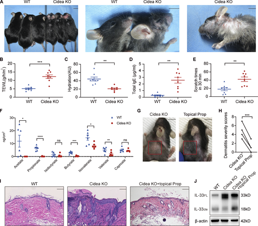Propionate attenuates spontaneous AD-like dermatitis in sebum-deficient mice. (A) Gross appearance of skin lesions in Cidea KO and WT mice. The line down the middle of this panel is used to divide the two types of mice. (B–E) TEWL (B), epidermal hydration (C), total serum IgE (D), and scratching frequency (E) in Cidea KO and WT mice (n = 8 per group). (F) SCFA levels on the skin surface of Cidea KO and WT mice (n = 6 per group). (G) Gross appearance of skin lesions in Cidea KO mice before and after topical propionate treatment. The red box indicates the skin lesions treated with propionate. (H) The severity scores of skin lesions in Cidea KO mice before and after propionate treatment (n = 4). (I) H&E staining of skin samples from WT mice, lesional skin of Cidea KO mice, and lesional skin of Cidea KO mice treated with propionate. (J) Western blotting showing the protein expression of IL-33 in skin samples of WT mice, lesional skin of Cidea KO mice, and lesional skin of Cidea KO mice treated with propionate (Prop). Scale bar = 1 cm (A and G); 100 μm (I). Data are representative of three independent experiments and are expressed as means ± SEM. Statistical significance was analyzed by unpaired t test with Welch’s correction (B–F) and paired t test (H). *, P < 0.05; **, P < 0.01; ***, P < 0.001; ****, P < 0.0001. Source data are available for this figure: SourceData F6.