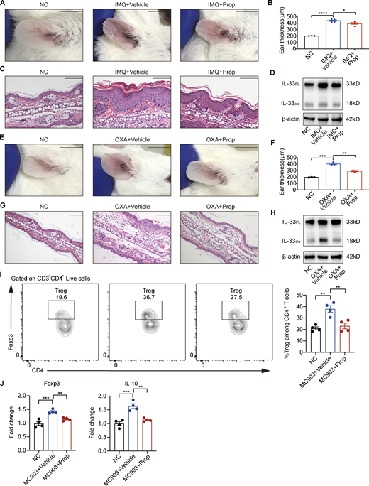 Topical propionate treatment attenuates IMQ-, OXA-, or MC903-induced skin inflammation in mice. (A–D) IMQ-induced psoriatic dermatitis was produced in the ears of mice, following which the animals were topically treated with propionate once daily for 14 d (n = 3–5 per group). Gross appearance of the ears (A), ear thickness (B), H&E staining of ear sections (C), and the protein expression of IL-33 in lesional ears (D) are shown. (E–H) The mouse model of contact hypersensitivity was generated using OXA, after which propionate was topically applied during the sensitization and challenge stages (n = 3 per group). Gross appearance of the ears (E), ear thickness (F), H&E staining of ear sections (G), and the protein expression of IL-33 in lesional ears (H) are shown. (I and J) MC903 or MC903 plus propionate (Prop)/vehicle was applied topically on the ears of WT BALB/c mice once daily for 9 d (n = 4 per group). (I) Representative flow cytometry dot plots of Tregs in ears of each mice group gated on CD3+ CD4+ live cells. Bar graphs on the right showing the percentage of Tregs within CD3+ CD4+ Foxp3+ gates among CD4+ T cells. (J) The mRNA expression of Foxp3 and IL-10 in the ears of mice in each group. IL-33FL, the full-length form of IL-33; IL-33cle, the cleaved form of IL-33. Scale bar = 1 cm (A and E); 100 μm (C and G). Data are representative of three independent experiments and are expressed as means ± SEM. Statistical significance was analyzed by one-way ANOVA followed by Tukey’s test. *, P < 0.05; **, P < 0.01; ***, P < 0.001; ****, P < 0.0001. Source data are available for this figure: SourceData FS2.