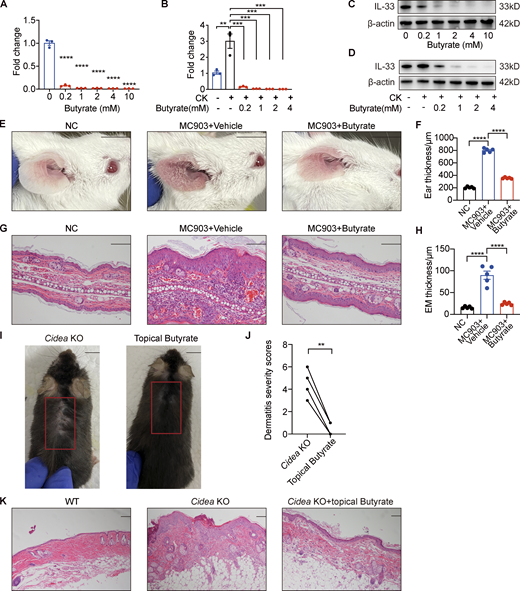 Butyrate suppresses IL-33 expression in keratinocytes and inhibits skin inflammation of AD mouse model. (A–D) IL-33 mRNA and protein expression in keratinocytes treated with different concentrations of butyrate (0.2–10 mM) in standard culture medium or supplemented with IL-4 and IL-1α for 24 h (n = 3 per group). (E–H) MC903 or MC903 plus butyrate (1 mM)/vehicle was applied topically on the ears of BALB/c mice once daily for 9 d (n = 5 per group). (E) Representative gross appearance of the ears. (F) Ear thickness of the mice in each group. (G) H&E staining of ear sections. (H) Epidermal (EM) thickness of ear sections under high-power magnification. (I–K)Cidea KO mice were topically applied with butyrate (1 mM) on the lesional skin twice daily for 21 d (n = 4 per group). (I) Gross appearance of skin lesions in Cidea KO mice before and after topical butyrate treatment. The red box indicates the skin lesions treated with butyrate. (J) Severity scores of skin lesions in Cidea KO mice before and after butyrate treatment. (K) H&E staining of skin samples from WT mice, lesional skin of Cidea KO mice, and lesional skin of Cidea KO mice treated with butyrate. Scale bar = 1 cm (E and I); 100 μm (G and K). Data are representative of three independent experiments and are expressed as means ± SEM. Statistical significance was analyzed by one-way ANOVA followed by Dunnett’s test (A and B) and paired t test (J). *, P < 0.05; **, P < 0.01; ***, P < 0.001; ****, P < 0.0001. Source data are available for this figure: SourceData FS4.