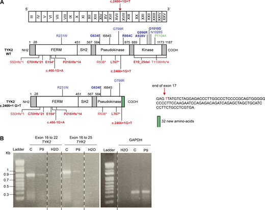 Characterization of the mutations of P8 and P9. (A) Schematic representation of the TYK2 cDNA with exons annotated (top), the TYK2 protein with all the mutated residues identified (middle), and a representation of the protein of P8 (bottom left) and the nucleotide sequence found in the cells of the patient (bottom right). (B) Amplification of the TYK2 cDNA from P9, revealing the presence of a single band of the same size as the WT protein, but of lower abundance, probably due to mRNA decay. Source data are available for this figure: SourceData FS2. Refer to the image caption for details.